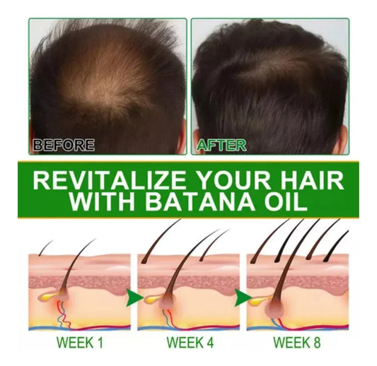Aceite de Batana - 0 Frizz, Nutre y Fortalece cabello
